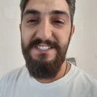 دندان طرح لمینت وسرامیکی باتحویل فوری