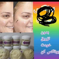 فروش همه نوع لوازم آرایشی درمانی چاقی لاغری ضدلک|آرایشی، بهداشتی، درمانی|دوگنبدان, |دیوار
