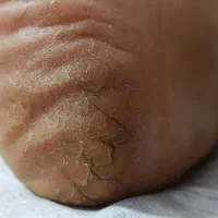 پدیکور و کفسابی تضمینی با پارافین تراپی|خدمات آرایشگری و زیبایی|شاهین‌شهر, عطار|دیوار