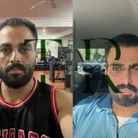 تخفیف کاشت مو با روش سلول بنیادی