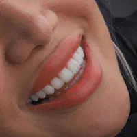مرکز تخصصی کامپوزیت در شیراز مطب دندانپزشکی|خدمات آرایشگری و زیبایی|شیراز, ملاصدرا|دیوار