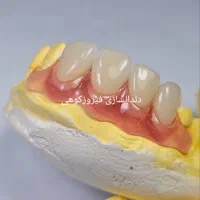 ساخت دندان مصنوعی تحویل یک روزفقط ۵میلیون|خدمات آرایشگری و زیبایی|زابل, |دیوار