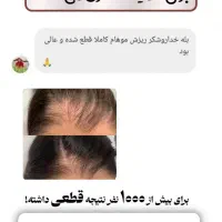 روغن تقویت و رشد مجدد مو