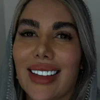 کامپوزیت/لمینیت/عصب کشی/روکش طلا|خدمات آرایشگری و زیبایی|تهران, دردشت|دیوار