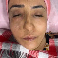 فیشال تخصصی،پاکسازی در مطب پزشک (خانم‌هاوآقایان)|خدمات آرایشگری و زیبایی|اهواز, کیانپارس |دیوار
