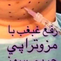 جشنواره ژل لب روسی و بوتاکس|خدمات آرایشگری و زیبایی|فردیس, شهرک ارم|دیوار