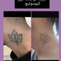 پاک کردن تتوخالکوبی/بدن ابرو لب چشم/بوتاکس کیوسویچ|خدمات آرایشگری و زیبایی|اصفهان, عباسآباد|دیوار