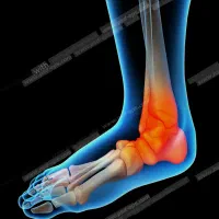 فیزیوتراپی و کاردرمانی در منزل تهران و کرج|خدمات آرایشگری و زیبایی|گرمدره, |دیوار