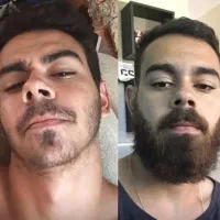 قطره معجزه آسا