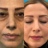 ضدلک اصل ژل رویال
