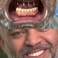 دندانپزشکی اقساطی