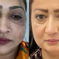 کرم معجزه شب|آرایشی، بهداشتی، درمانی|اردبیل, |دیوار