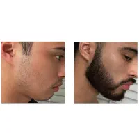جوون شو|آرایشی، بهداشتی، درمانی|مشگین شهر, |دیوار