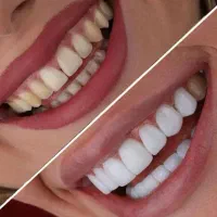 ارائه تمامی خدمات زیبایی با مناسب ترین قیمت