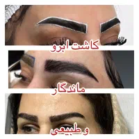 شرایط ویژه عیدانه کاشت مو و ابرو