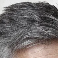 درمان جلوگیری از سفیدی مو و ریزش مو