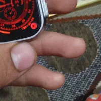 ساعت هوشمند اسمارت واچ|ساعت|قصابه, |دیوار