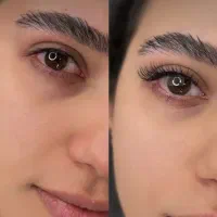 کاشت اکستنشن مژه