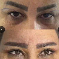تخفیف ویژه جراحی های زیبایی ( جراحی بینی۳۵)