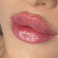لیفت/هایفو تزریق ژل نورامیس رئوفیل/لیزر توسطپزشک|خدمات آرایشگری و زیبایی|تهران, ستارخان|دیوار