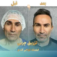 کلینک زیبایی گندم