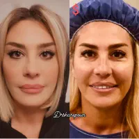 زیبایی و جوانی را دوباره تجربه کنید