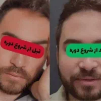 میخوای صورتی تپل داشته باشی پیام بده