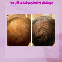 ریزش مو|آرایشی، بهداشتی، درمانی|تهران, راه آهن|دیوار
