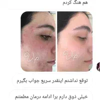 فروش همه نوع لوازم آرایشی درمانی چاقی لاغری ضدلک|آرایشی، بهداشتی، درمانی|دوگنبدان, |دیوار