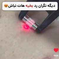 پاکسازی و فیشال/ آقایان و بانوان|خدمات آرایشگری و زیبایی|هشتگرد, هشتگرد قدیم|دیوار