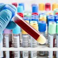 آموزش صفر تا صد کار در آزمایشگاه تشخیص طبی|خدمات آموزشی|تبریز, |دیوار