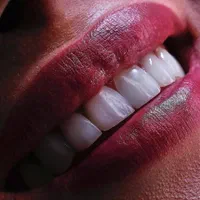 انجام خدمات دندانپزشکی همه سنین تحت بیهوشی