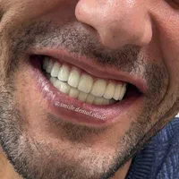 خدمات دندان پزشکی با شرایط اقساطی