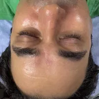 فیشال تخصصی و لیزر موهای زائد زیر نظر پزشک|خدمات آرایشگری و زیبایی|رشت, رشتیان|دیوار