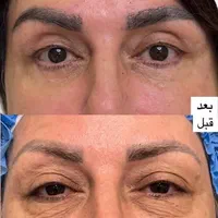 جراحی و زیبایی صورت و بدن، مزو، بوتاکس، چربی، فیلر|خدمات آرایشگری و زیبایی|کرمانشاه, |دیوار