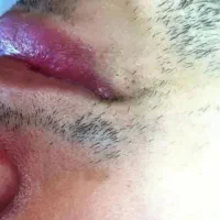 الکترولیز تنها روش قطعی از بین بردن هر نوع مو|خدمات آرایشگری و زیبایی|صدرا-فارس, فاز ۱|دیوار