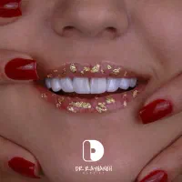 کامپوزیت/لمینت/دندانپزشکی|خدمات آرایشگری و زیبایی|مشهد, کوثر|دیوار