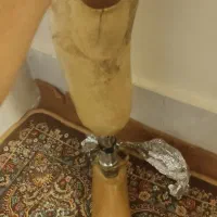 فروش پا مصنوعی پروتزی فولادی در حد نو
