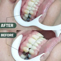 ایمپلنت و لمینیت اقساطی ( فولادشهر )|خدمات آرایشگری و زیبایی|فولادشهر, B2|دیوار