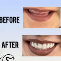 دندانسازی بهزاد