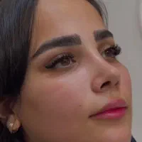 جراحی زیبایی فقط ۴۳ میلیون تهران