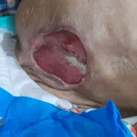 خدمات پرستاری پزشکی پانسمان تزریقات|پزشکی|اهواز, گلستان|دیوار