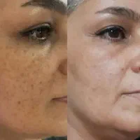 کرم بیوممتیک