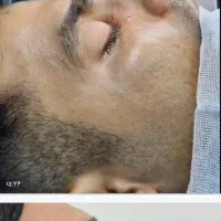 جشنواره جراحی بینی۲۵ تومن .جراحی صورت واندام|خدمات آرایشگری و زیبایی|اسلامشهر, شهرک مهدیه|دیوار