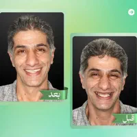 مرکز تخصصی ایمپلنت دیجیتال/اقساط/یکروزه/کاشت دندان|خدمات آرایشگری و زیبایی|تهران, پاسداران|دیوار
