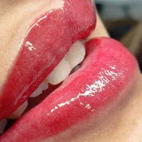 میکرو ریمو لیفت تتو ابرو سالن ارایش صورت