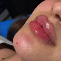 نیازمند مدل فوری ژل لب تکنیک M/خ اردیبهشت