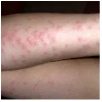 سم پاشی وضدعفونی اماکن ومنازل باسابقه ۱۴سال|خدمات نظافت|گرگان, |دیوار