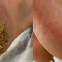 پدیکور تخصصی پا (مخصوص بانوان)