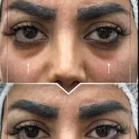 پیرن جدید